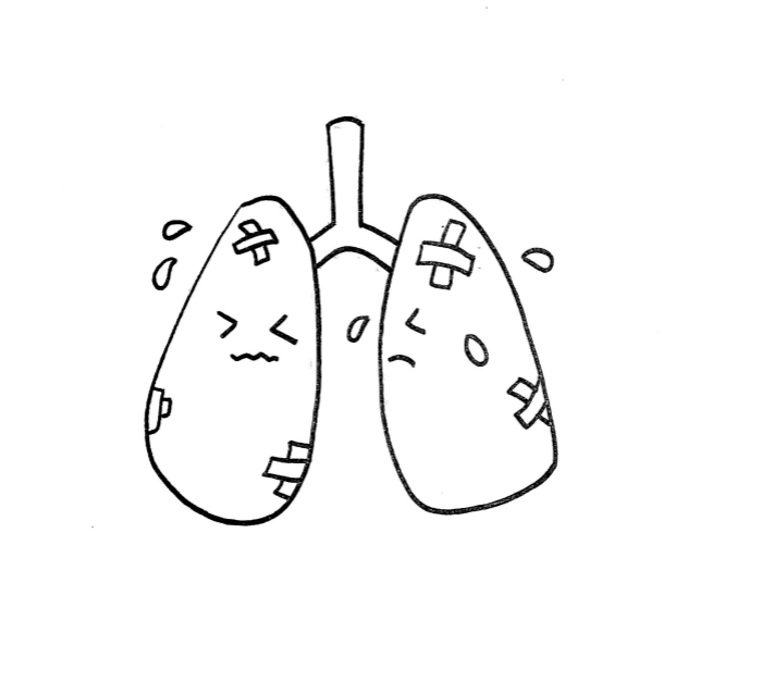 肺炎簡筆畫 肺炎簡筆畫
