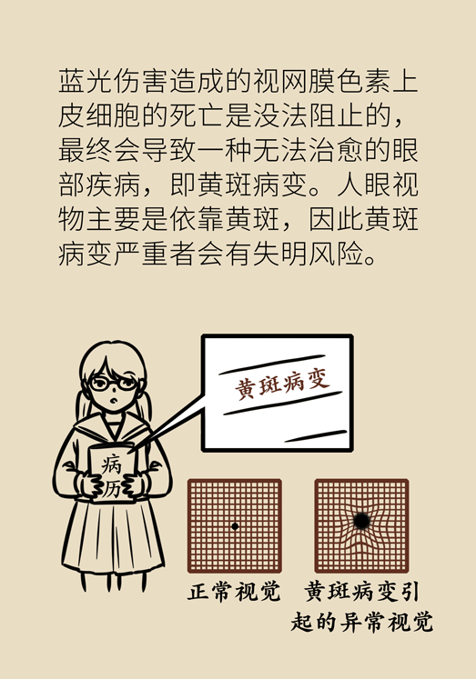 防藍光眼睛保護是怎么回事？