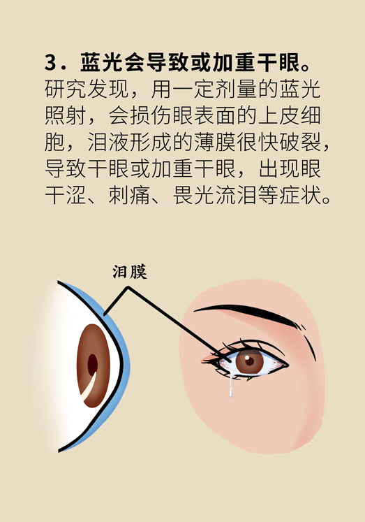 防藍光眼睛保護是怎么回事？
