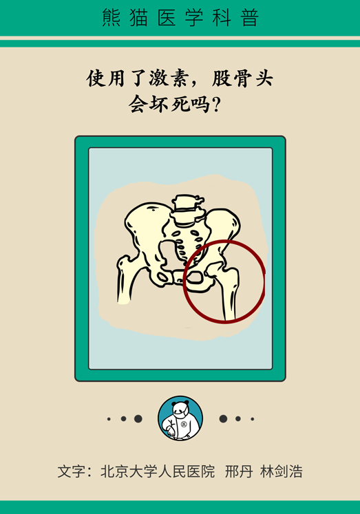 激素會帶來股骨頭壞死的后遺癥嗎？
