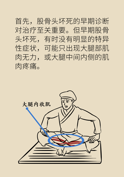 激素會帶來股骨頭壞死的后遺癥嗎？