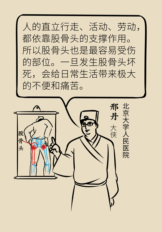 激素會帶來股骨頭壞死的后遺癥嗎？