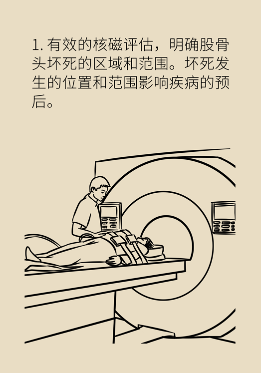 激素會帶來股骨頭壞死的后遺癥嗎？