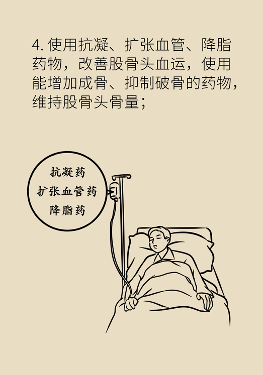 激素會帶來股骨頭壞死的后遺癥嗎？