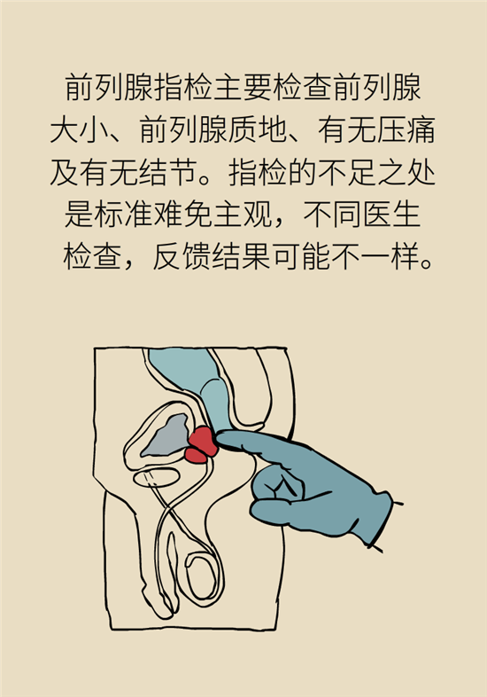 前列腺肥大了還能縮小嗎？