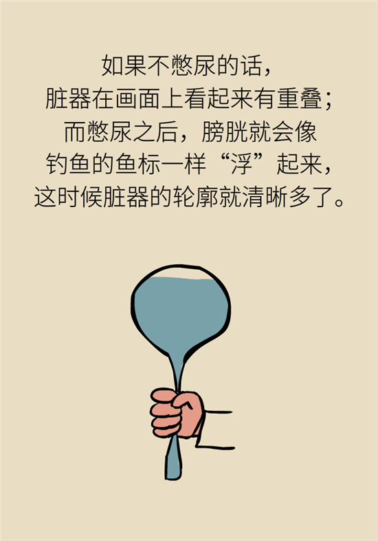 前列腺肥大了還能縮小嗎？