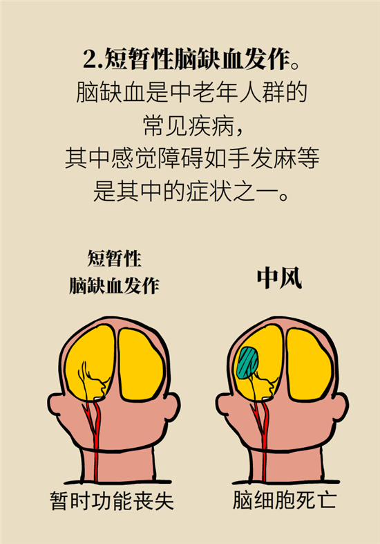 無(wú)緣無(wú)故的手麻，這是身體發(fā)出的什么信號(hào)？