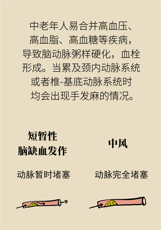 無(wú)緣無(wú)故的手麻，這是身體發(fā)出的什么信號(hào)？