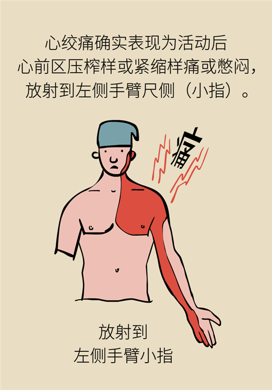 什么是冠心病，這些疼痛可能是心絞痛！