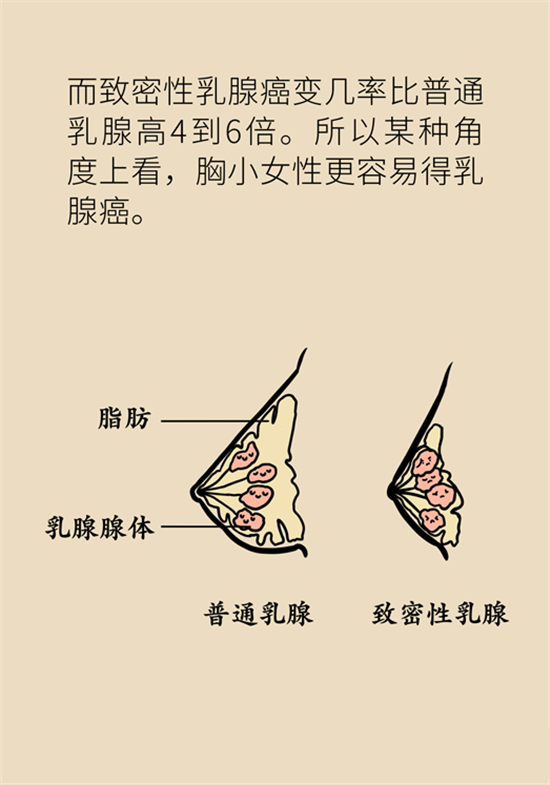 胸小是不是就不會(huì)患乳腺癌？