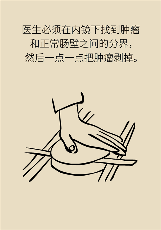 腸鏡檢查科普動(dòng)漫制作 腸鏡檢查科普動(dòng)漫制作