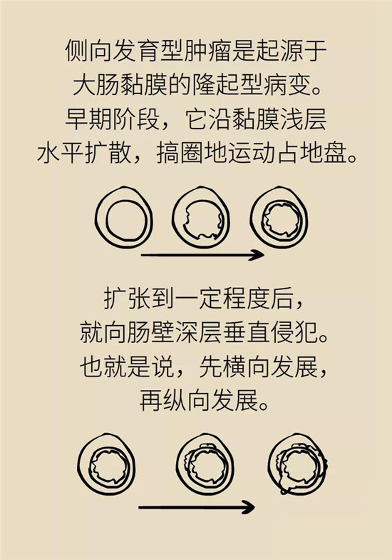 腸鏡檢查科普動(dòng)漫制作 腸鏡檢查科普動(dòng)漫制作