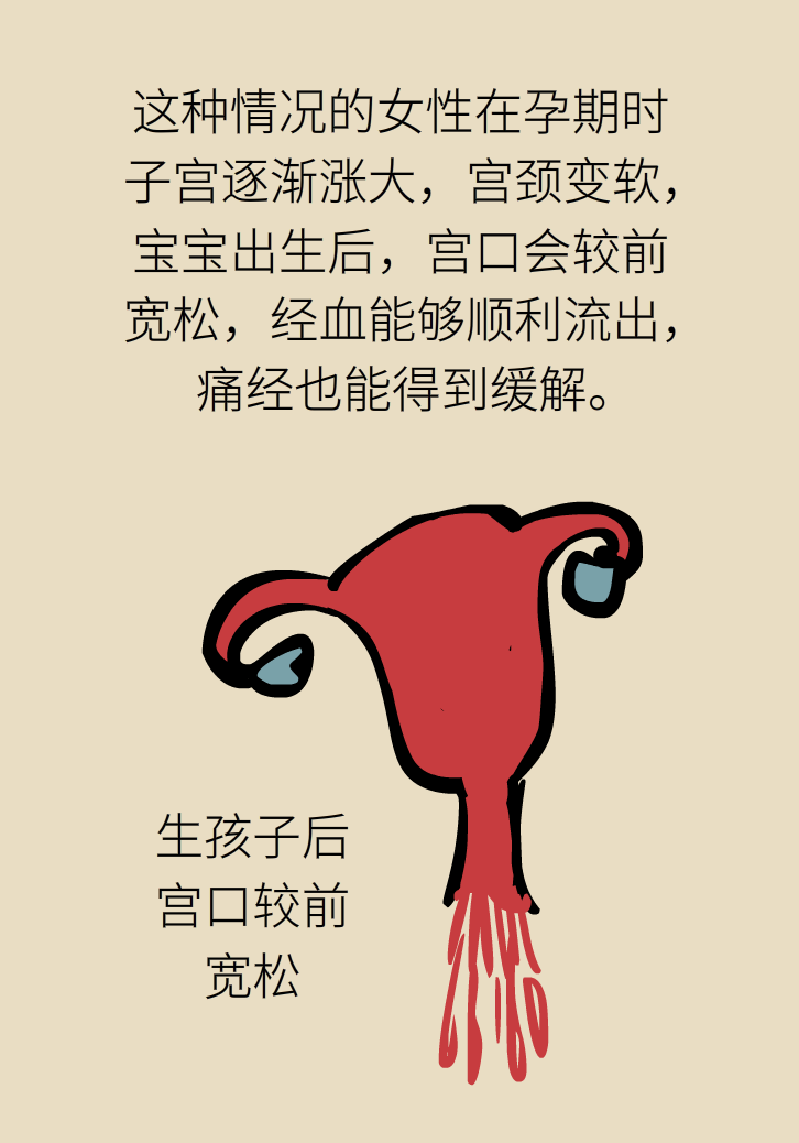 生孩子后痛經(jīng)會消失，是真的嗎？