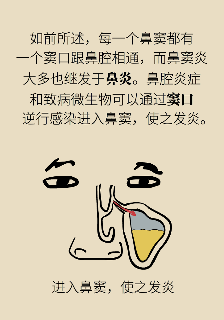 為什么鼻竇發(fā)炎，疼的卻是頭、眼和牙？