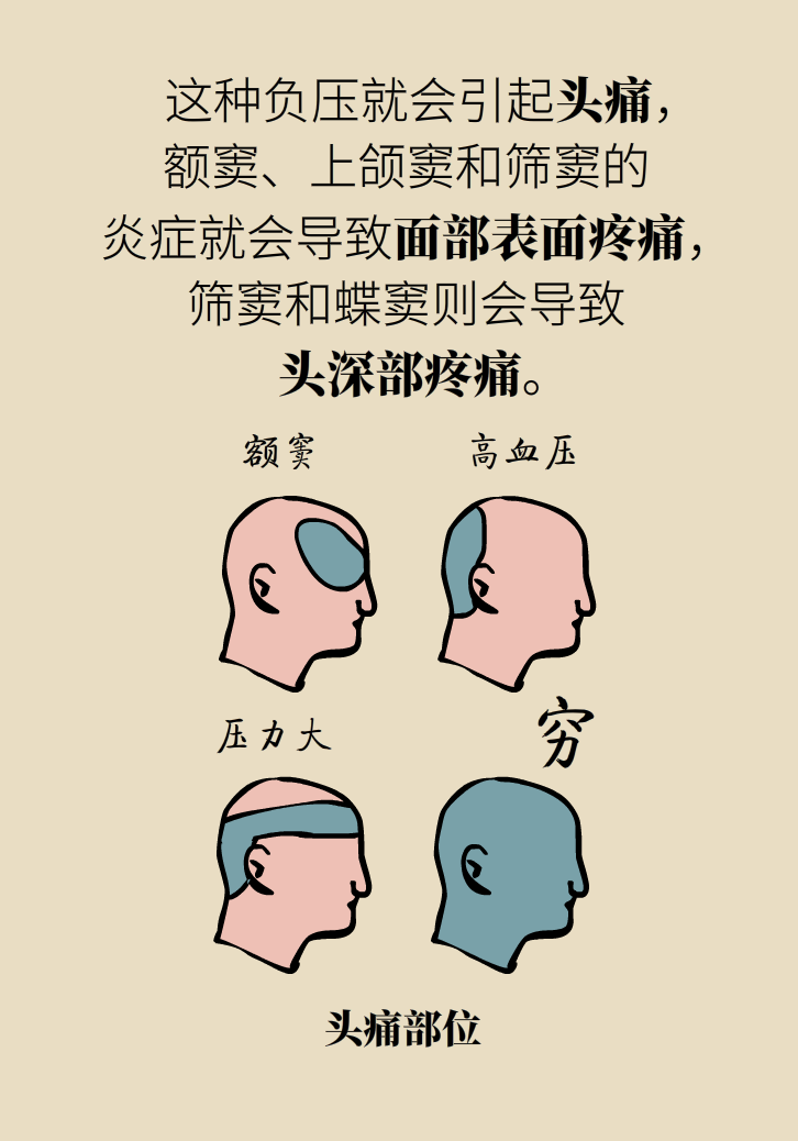 為什么鼻竇發(fā)炎，疼的卻是頭、眼和牙？