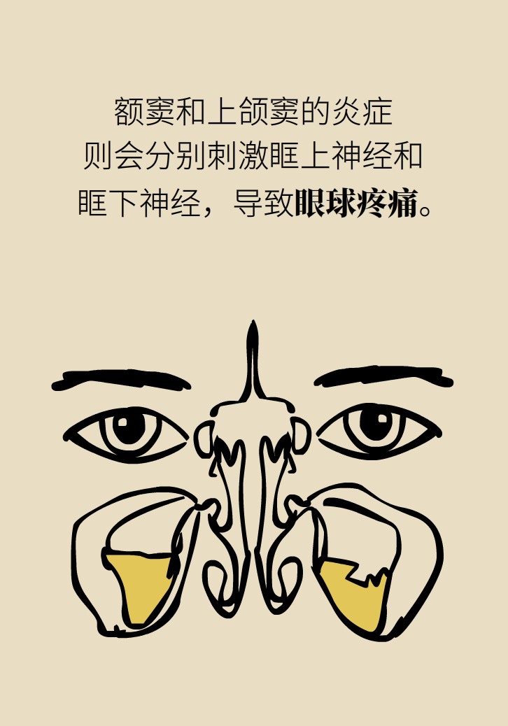 為什么鼻竇發(fā)炎，疼的卻是頭、眼和牙？