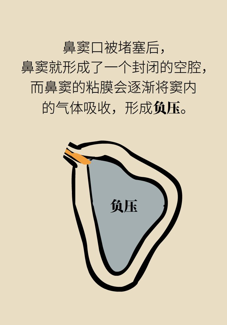 為什么鼻竇發(fā)炎，疼的卻是頭、眼和牙？