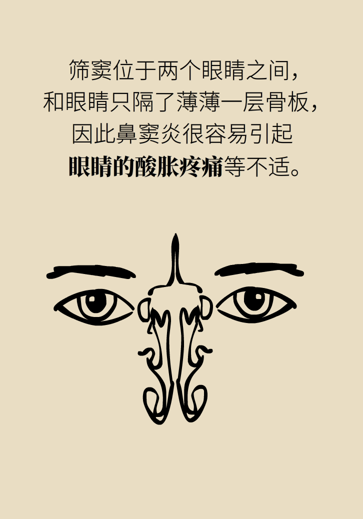 為什么鼻竇發(fā)炎，疼的卻是頭、眼和牙？