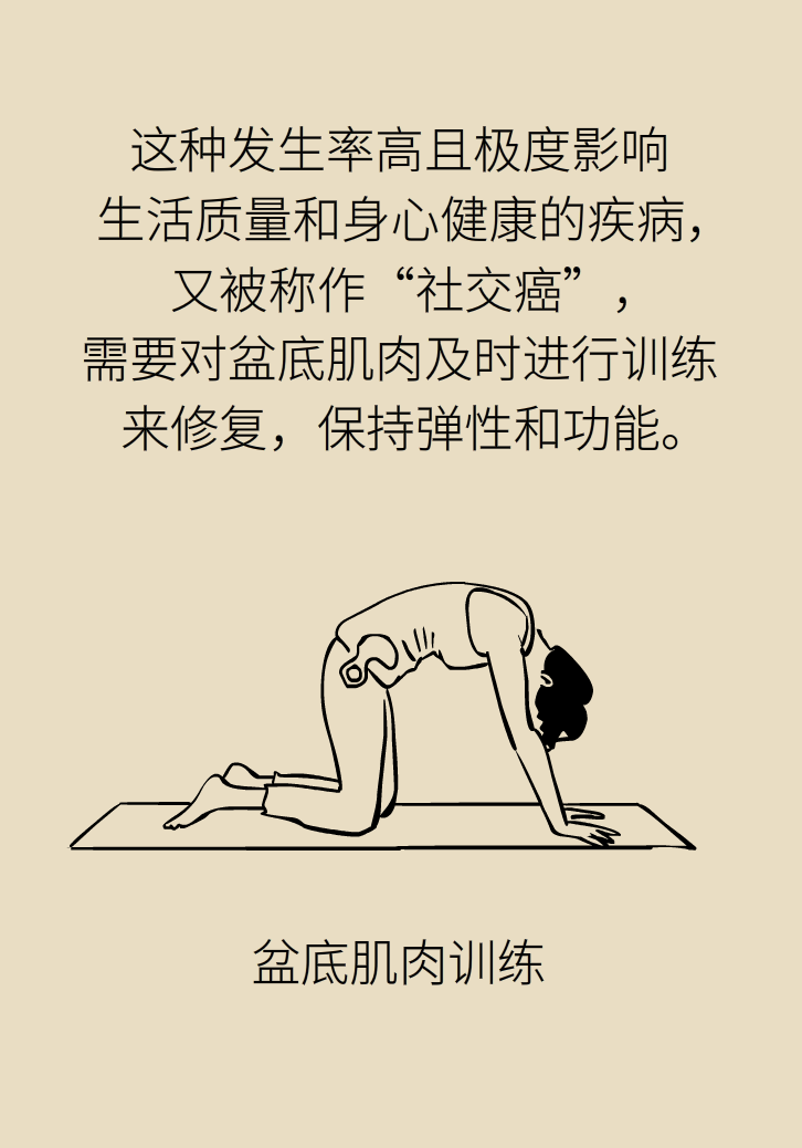 選擇剖腹產(chǎn)，就能避免盆底肌損傷嗎？