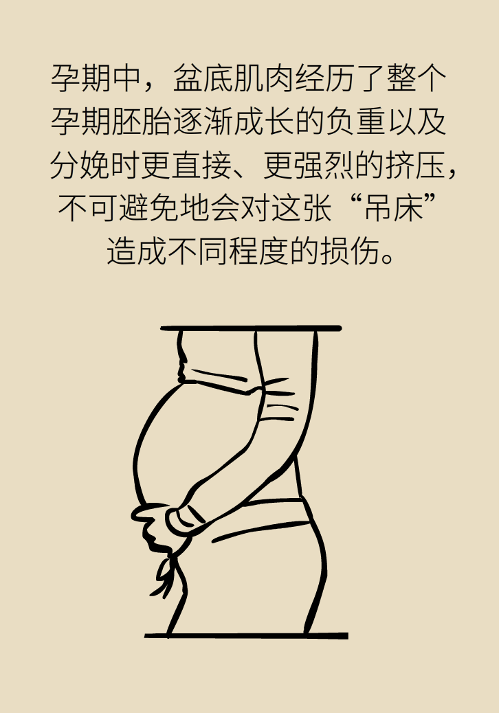 選擇剖腹產(chǎn)，就能避免盆底肌損傷嗎？