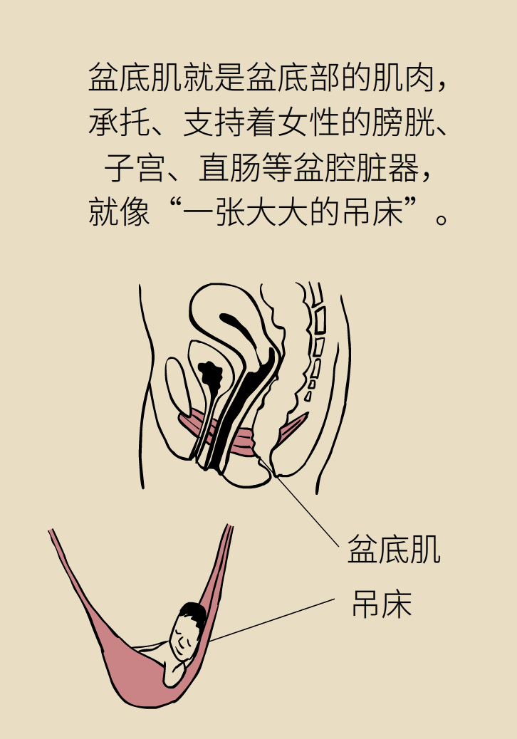 選擇剖腹產(chǎn)，就能避免盆底肌損傷嗎？