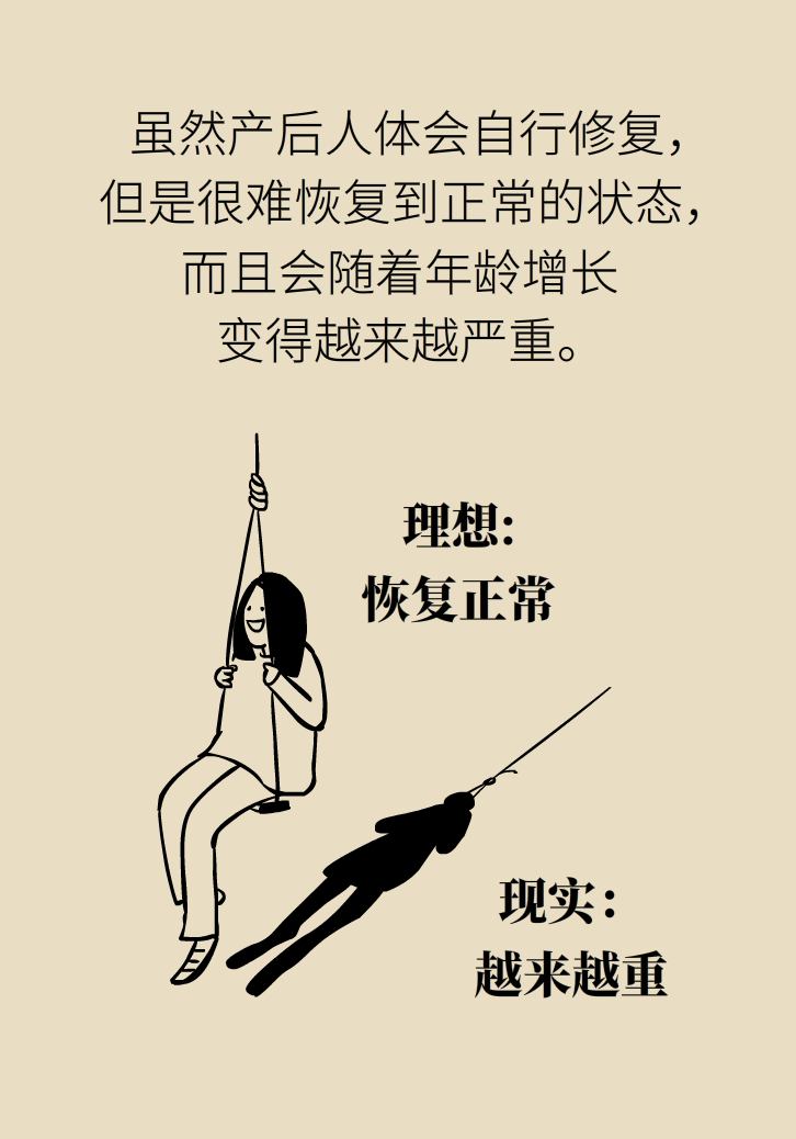 選擇剖腹產(chǎn)，就能避免盆底肌損傷嗎？