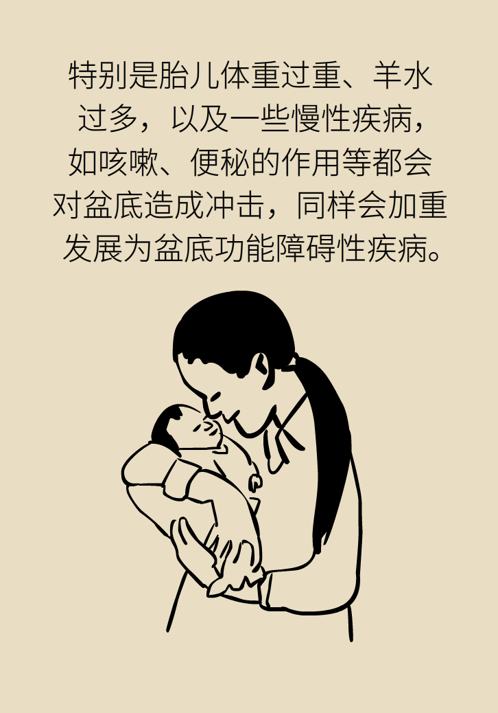 選擇剖腹產(chǎn)，就能避免盆底肌損傷嗎？