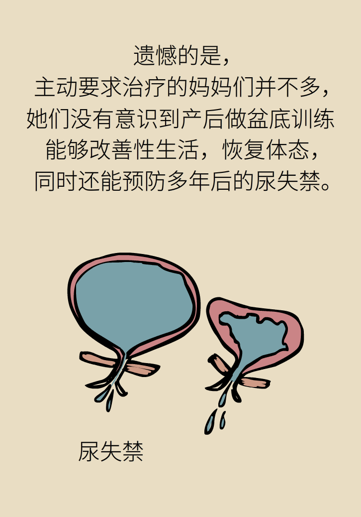 選擇剖腹產(chǎn)，就能避免盆底肌損傷嗎？