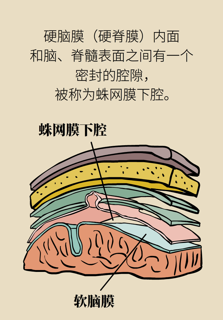 練瑜伽把腦脊液拉漏了！常見的“瑜伽病”你知道多少
