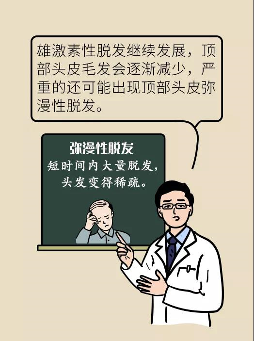 頭發(fā)一把一把地掉？搞明白根源才能對癥下藥