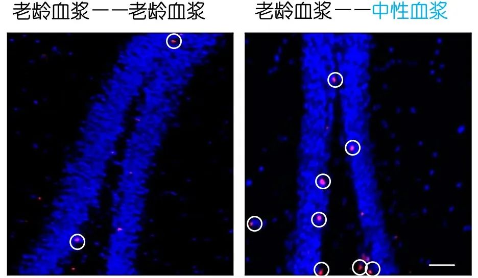 重返年輕不用大換血，只要給血液“兌點(diǎn)水”？
