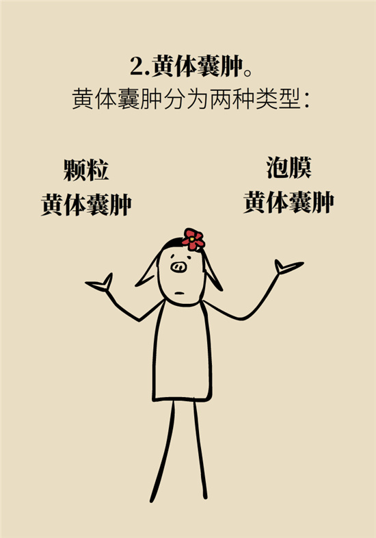 卵巢囊腫科普動漫：卵巢囊腫是腫瘤嗎？要學會這樣區(qū)分