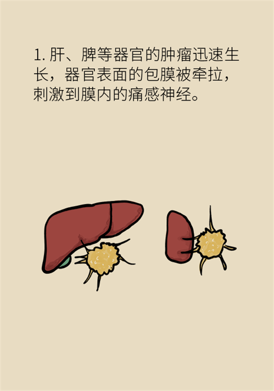 癌癥到底有多痛？需要注意這7個(gè)重點(diǎn)問(wèn)題