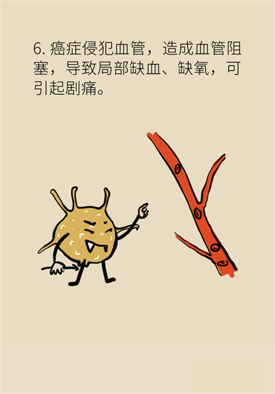 癌癥到底有多痛？需要注意這7個(gè)重點(diǎn)問(wèn)題