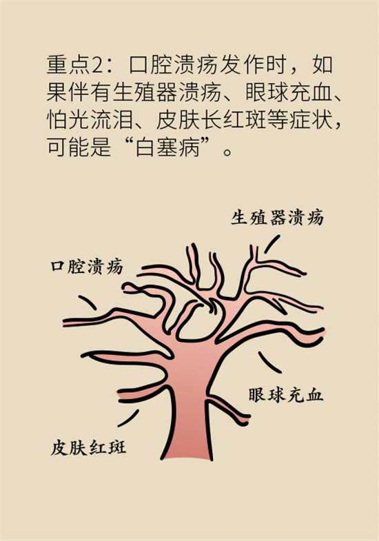 口腔潰瘍還想約火鍋？這四種情況一定要高度警惕