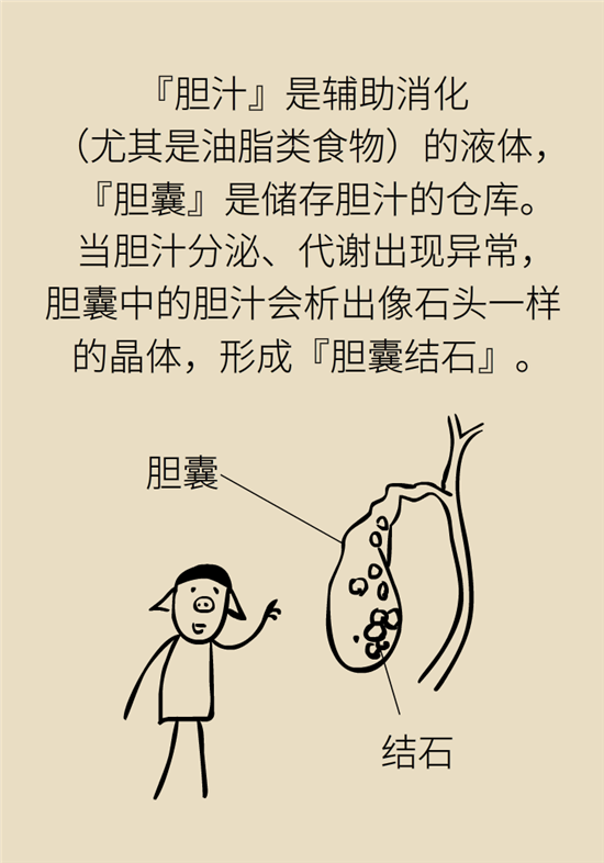 結(jié)石科普：身體里多了各種結(jié)石，應(yīng)該怎么辦？