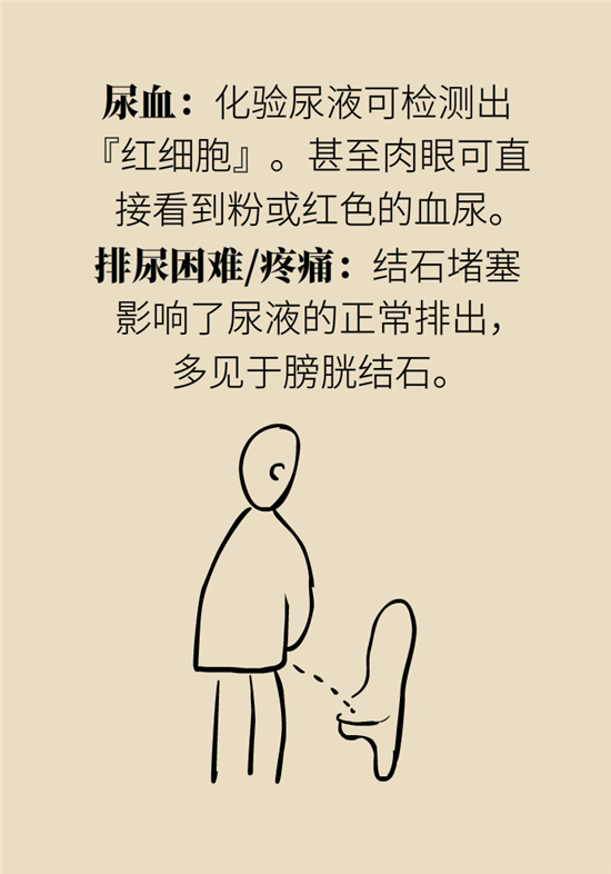 結(jié)石科普：身體里多了各種結(jié)石，應(yīng)該怎么辦？