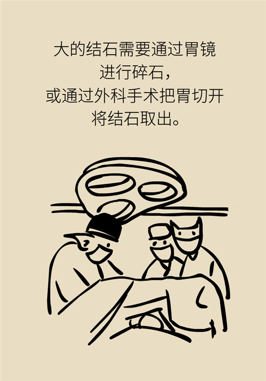 結(jié)石科普：身體里多了各種結(jié)石，應(yīng)該怎么辦？