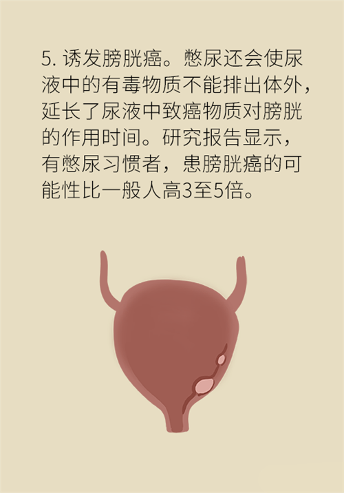 憋尿的7大危害，你真的了解嗎？