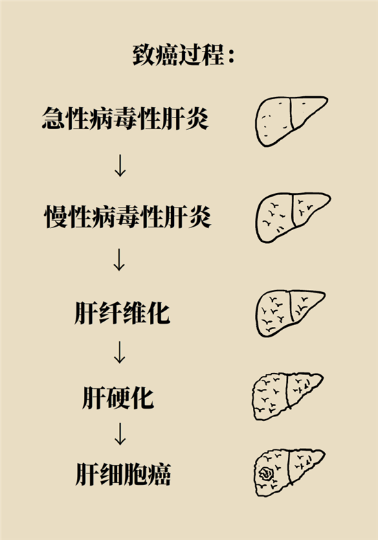 癌癥會傳染嗎？專家：這些高危因素得注意