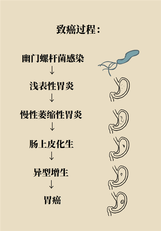癌癥會傳染嗎？專家：這些高危因素得注意