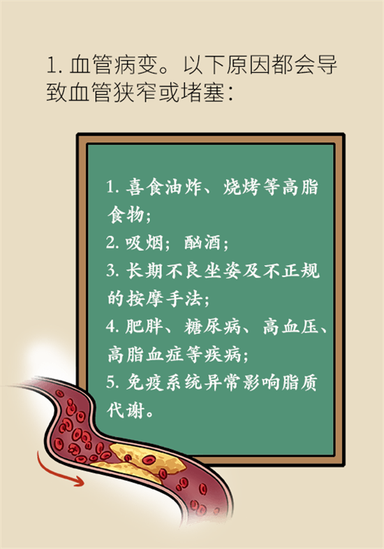 年紀(jì)輕輕別大意，小心腦卒中