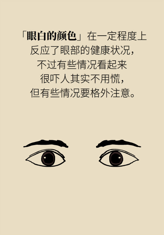 眼白有斑塊、出血要緊嗎？專家：名字唬人但問(wèn)題不大