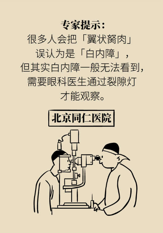 眼白有斑塊、出血要緊嗎？專家：名字唬人但問(wèn)題不大
