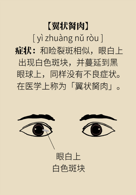眼白有斑塊、出血要緊嗎？專家：名字唬人但問(wèn)題不大