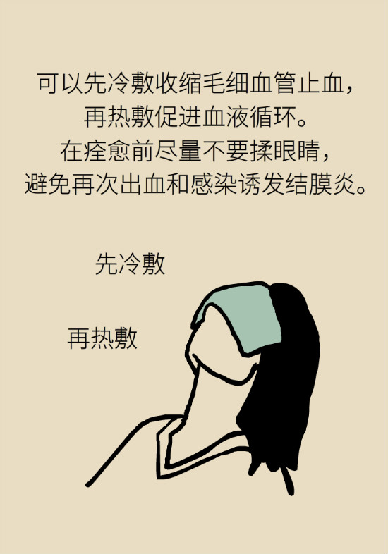 眼白有斑塊、出血要緊嗎？專家：名字唬人但問(wèn)題不大
