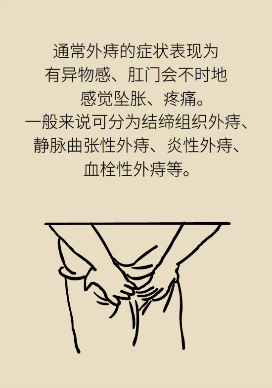 長(zhǎng)“痔”如何久安？專(zhuān)家的建議來(lái)了