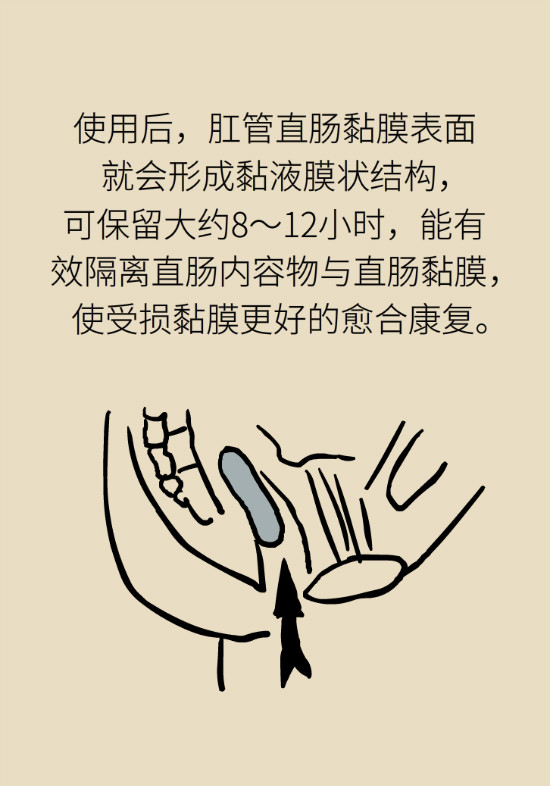 長(zhǎng)“痔”如何久安？專(zhuān)家的建議來(lái)了