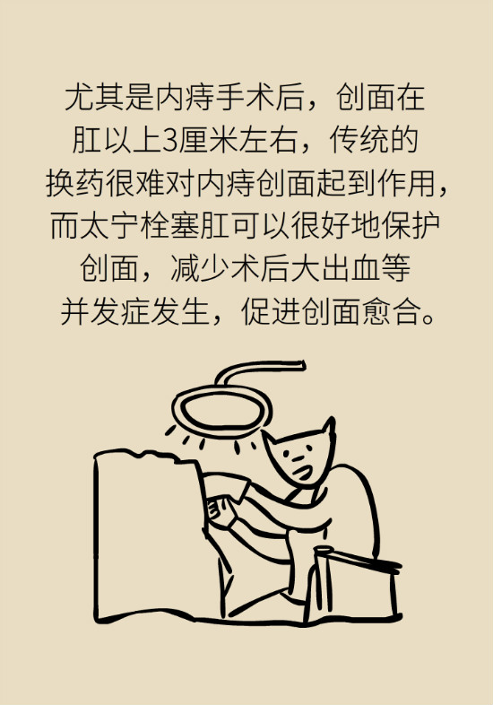 長(zhǎng)“痔”如何久安？專(zhuān)家的建議來(lái)了