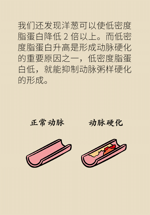 洋蔥可以預(yù)防動(dòng)脈硬化，是真的嗎？